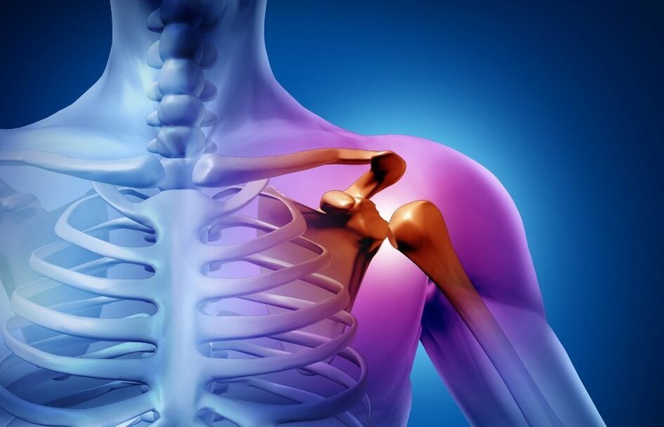 osteocondroza omoplatului stâng durere acută de spate